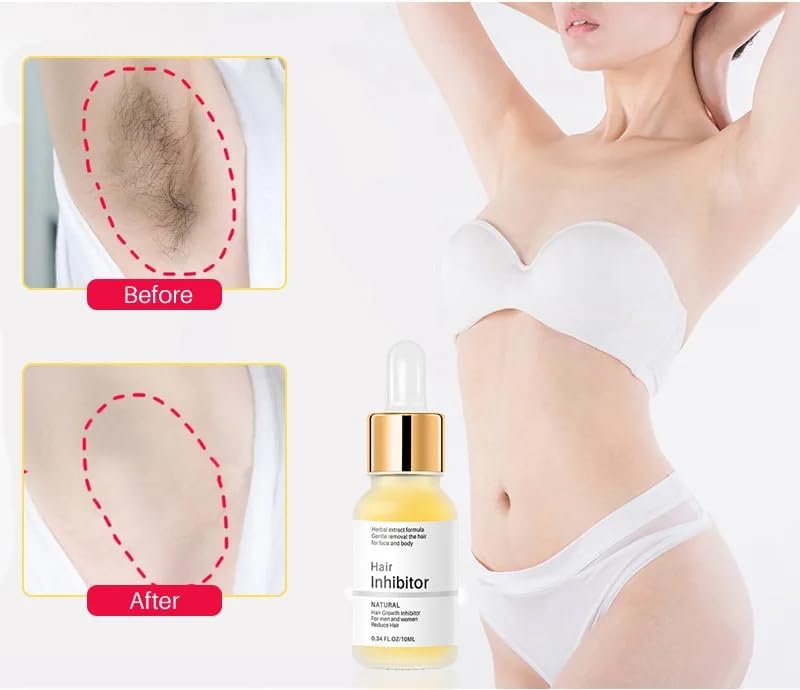 Seraphine ® Depilazione impeccabile del corpo - Shopella