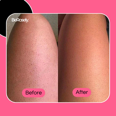 Berosly RadiantSkin™ - Shopella