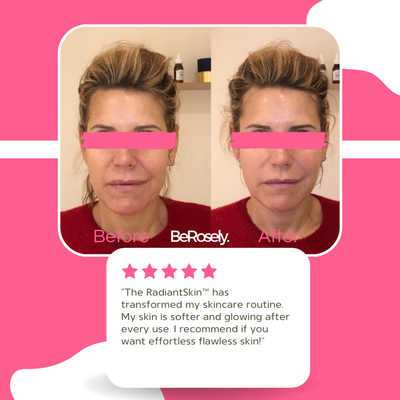 Berosly RadiantSkin™ - Shopella