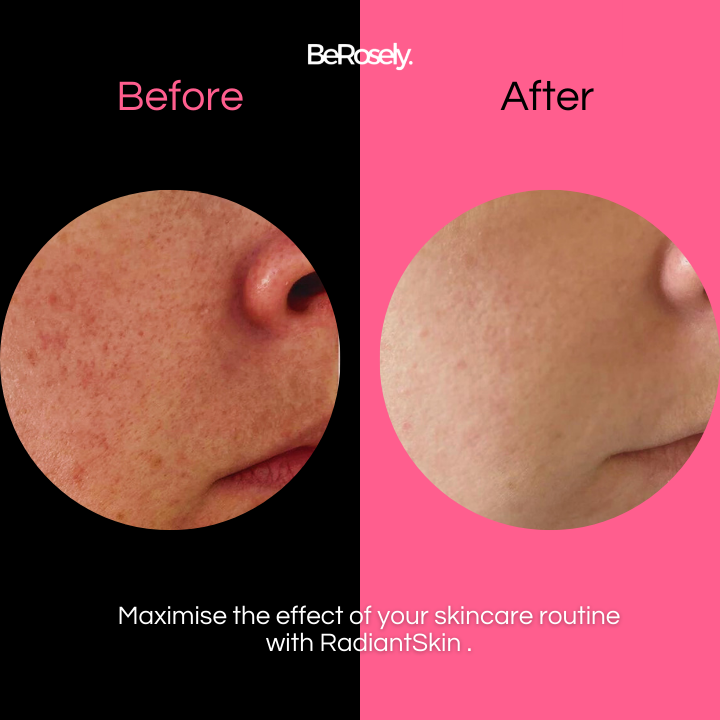 Berosly RadiantSkin™ - Shopella