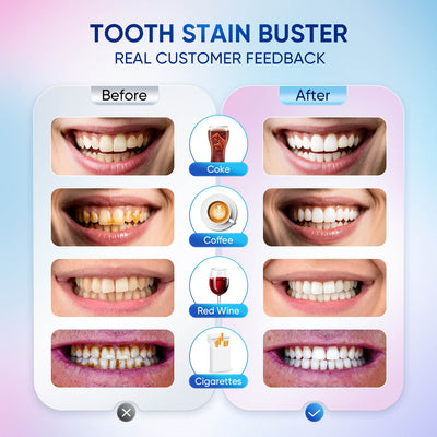 BodyAccel ® | Dentifricio sbiancante alla niacinamide - Shopella